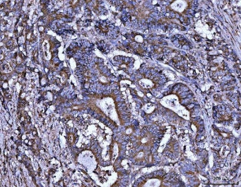ALDH1A2 Antibody