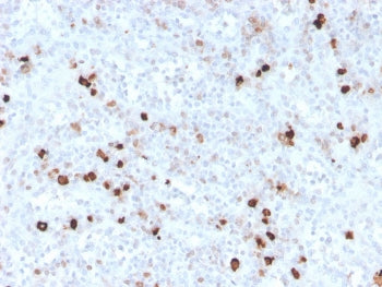 IgM Heavy Chain Antibody