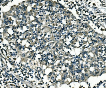 PCTAIRE1 Antibody / PCTK1 / CDK16