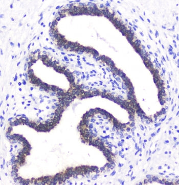 BTC Antibody / Betacellulin