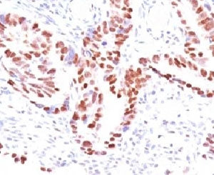 p57 Antibody / p57Kip2