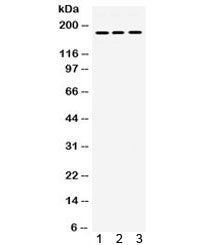 Platelet Derived Growth Factor Receptor alpha Antibody / PDGFRA
