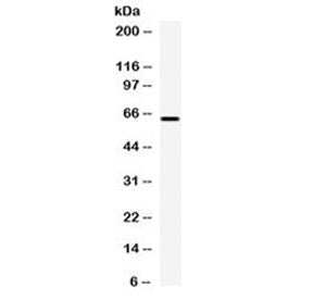 Western blot testing of human HepG2 cell lysate with Carboxypeptidase M antibody at 0.5ug/ml. Expect
