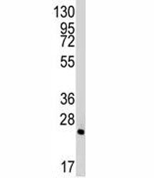 Western blot analysis of Bid antibody and mouse lung tissue lysate. Predicted molecular weight ~22 k