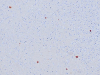 HSV1 Antibody / Herpes Simplex Virus Type I