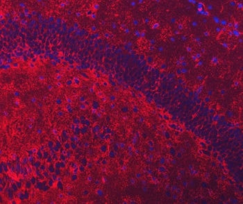Immunofluorescent staining of FFPE mouse brain tissue with EAAT2 antibody (red) and DAPI nuclear sta