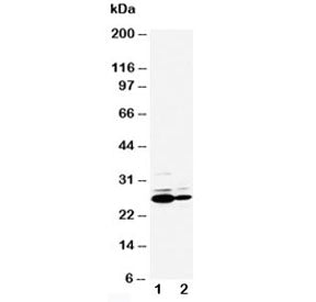 Western blot testing of C Reactive protein antibody and Lane 1: SMMC-7721; 2: HT1080 cell lysate. Pr