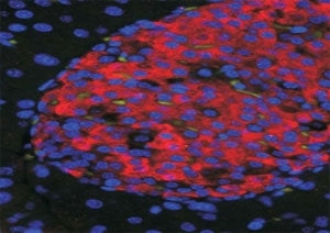 UNC5C Antibody