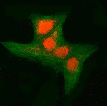 RNF34 Antibody / hRFI / CARP-1
