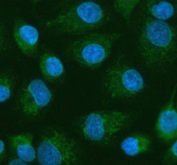 Western blot testing of PDK2 antbody on Lane 1: rat heart; 2: HeLa; 3: SW620; 4: MCF-7 cell lysate.