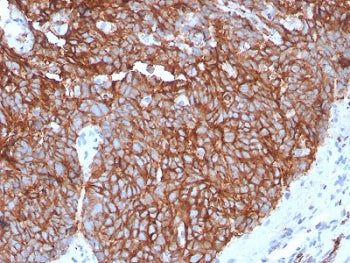 IHC testing of human tongue with recombinant GLUT1 antibody. Required HIER: boil tissue sections in