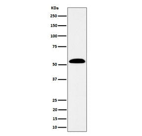Western blot testing of human SW480 cell lysate with Aldehyde dehydrogenase 7A1 antibody. Predicted