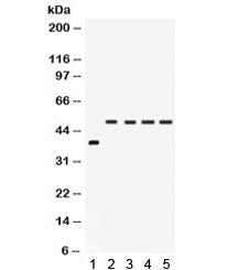 Western blot testing of 1) rat intestine and human 2) SW620, 3) COLO320, 4) HeLa and 5) A549 lysate