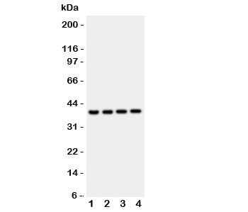 Cathepsin D Antibody