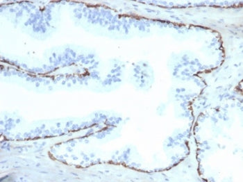 IHC staining of FFPE human prostate tissue with Cytokeratin 14 antibody (clone KRT14/6987R). HIER: b