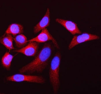 SAMD1 Antibody / SAM domain-containing protein 1 / Atherin