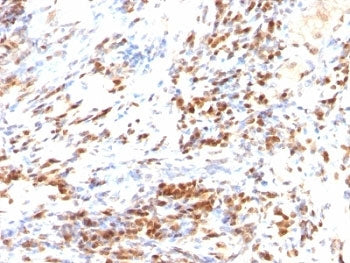 p27 Antibody Cocktail / p27Kip1