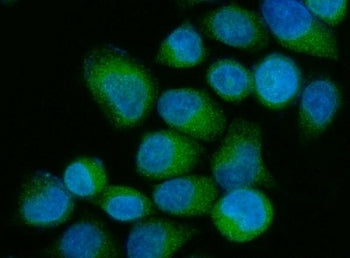 OS9 Antibody / Amplified in Osteosarcoma 9