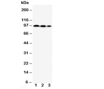 Western blot testing of HIF2a antibody and Lane 1: HeLa; 2: MCF-7; 3: Jurkat cell lysate