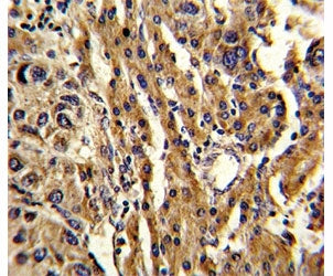 ABCG1 Antibody