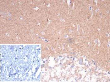 NCAM / CD56 Antibody