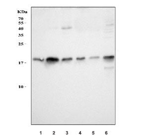 Western blot testing of 1) rat liver, 2) rat spleen, 3) rat stomach, 4) rat RH35, 5) mouse liver and