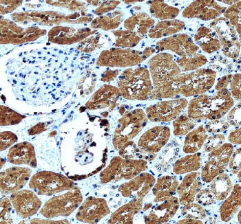 IHC staining of FFPE human kidney tissue with GLRX antibody, HRP-secondary and DAB substrate. HIER:
