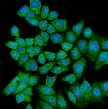 RCC2 Antibody