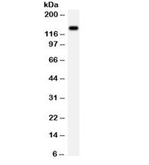 Western blot testing of rat brain lysate with NMDAR2C antibody. Expected/observed molecular weight ~