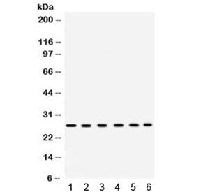 EIF6 Antibody / Eukaryotic Translation Initiation Factor 6