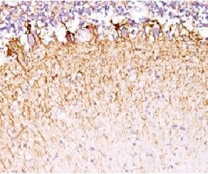 Neurofilament Antibody (-Light) / NF-L / NEFL