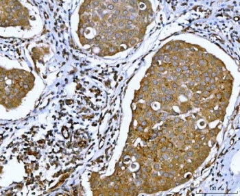Ataxin-2 Antibody