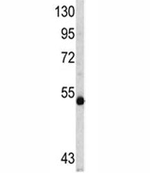 MYCN Antibody