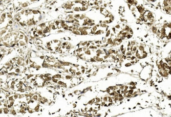 APE1 Antibody / APEX1