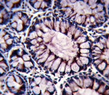 PIGR Antibody