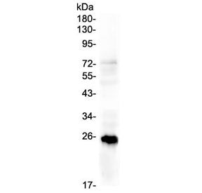 PLGF Antibody / PGF / Placenta Growth Factor