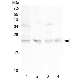 TIMP1 Antibody