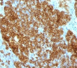 CD45RA Antibody (Leukocyte marker)