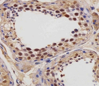 ZBP-1 Antibody / IGF2BP1