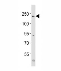 Western blot testing of Alk antibody at 1:2000 dilution + mouse cerebellum lysate; Predicted molecul