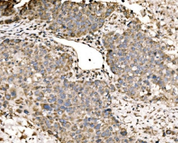LACTB Antibody / MRPL56