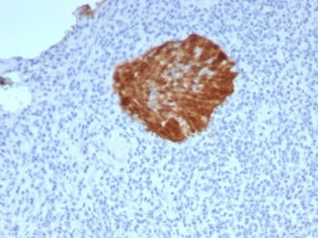 p16INK4a Antibody / CDKN2A