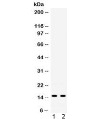 Western blot testing of human 1) 22RV1 and 2) HeLa cell lysate with ISG15 antibody. Expected molecul