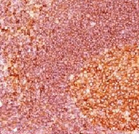 MALT1 Antibody