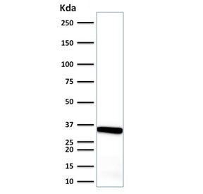 Western blot testing of human endometrium tissue lysate with Calponin antibody. Predicted molecular