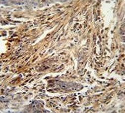 Granulocyte-Macrophage CSF Antibody / CSF2