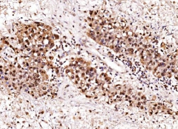 Aurora-A Antibody / AURKA