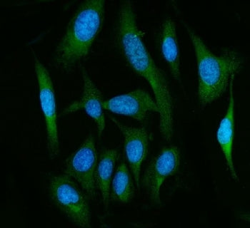 FAAH Antibody / Fatty-acid amide hydrolase 1