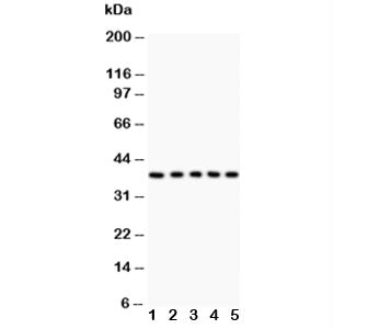 Fas Antibody