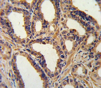 Atrial Natriuretic Peptide/Factor Antibody / ANP / ANF